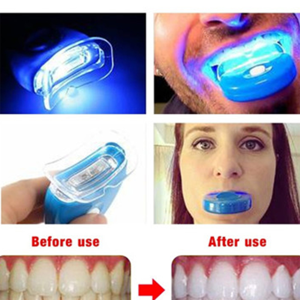 LED 치아 미백 라이트 미백 블루 라이트 UV 라이트 - Teeth Whitening Laser Treatment 리뷰 및 가격