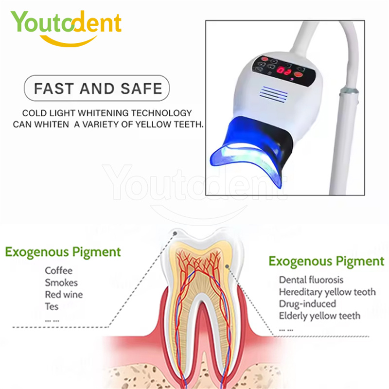 전문 치과용 3색 광 램프 치아 미백기 미백 촉진 장치 - Teeth Whitening Dental 리뷰 및 가격