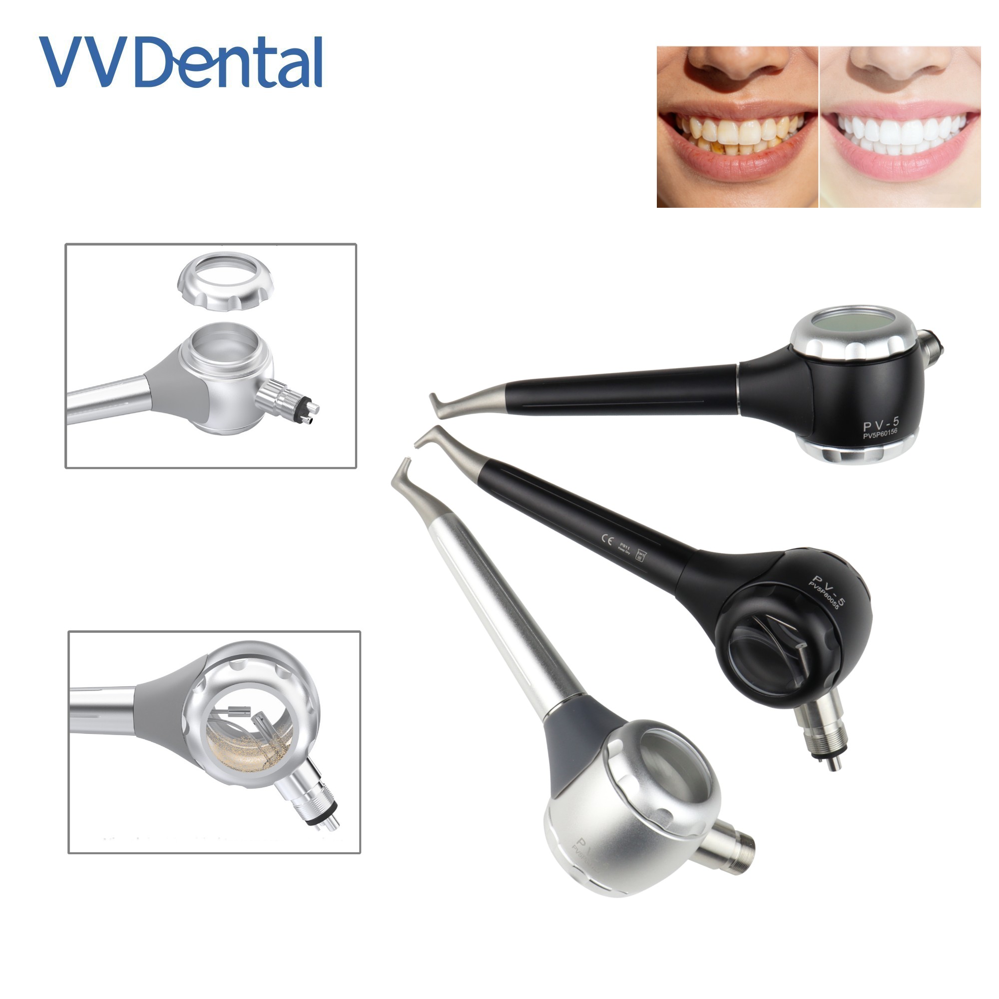 VV 치과용 2/4홀 치아 미백 샌드블라스팅 건 양면  - Teeth Whitening Dental 리뷰 및 가격