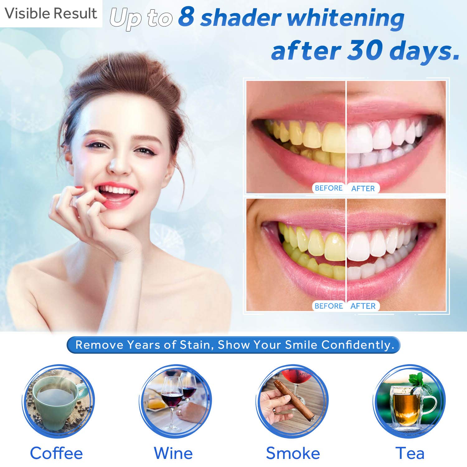 치아 미백 젤 리필 주사기 치아 미백 젤 인비스알라인  - Teeth Whitening Q&M 리뷰 및 가격