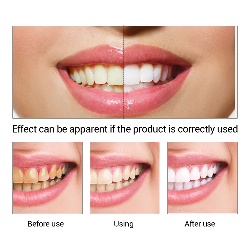 FTEENPLY 치아 미백 에센스 파우더 구강 위생 청 - Teeth Whitening Q&M 리뷰 및 가격