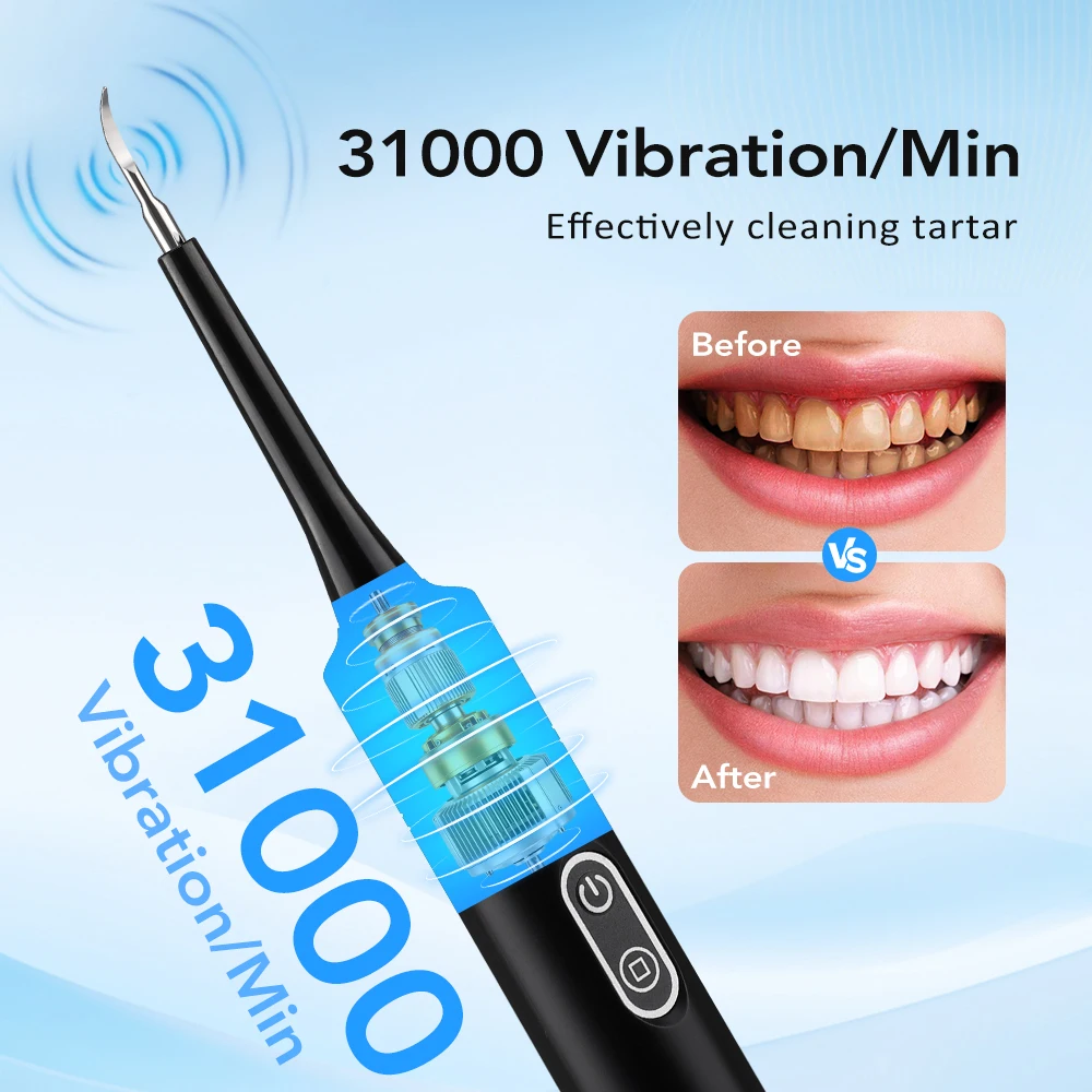 전동 음파 진동 치석 제거기 치아 미백 플라그 제거 치 - Teeth Whitening Express 리뷰 및 가격